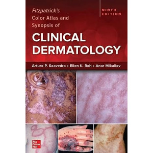  Fitzpatrick's Color Atlas and Synopsis of Clinical Dermatology, 9/e Δερματολογία