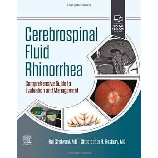 Cerebrospinal Fluid Rhinorrhea 