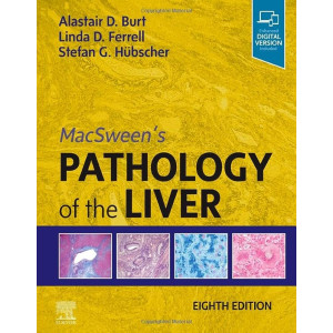 MacSween's Pathology of the Liver, 8th Edition Παθολογοανατομία