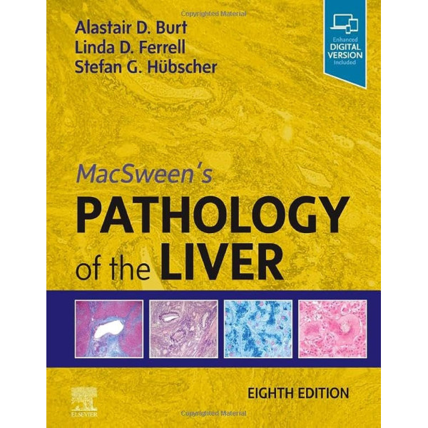 MacSween's Pathology of the Liver, 8th Edition Παθολογοανατομία