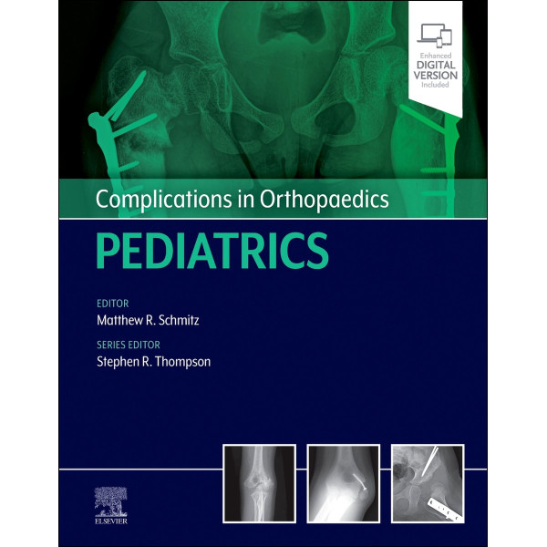 Complications in Orthopaedics: Pediatrics Ορθοπεδική