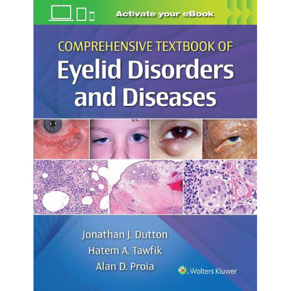 Comprehensive Textbook of Eyelid Disorders and Diseases 