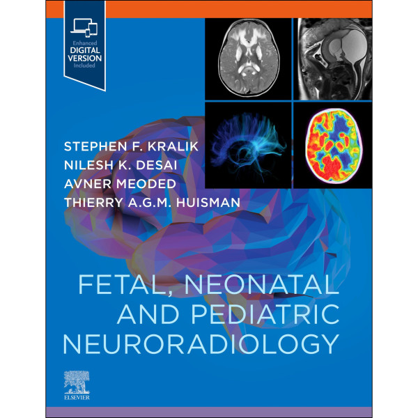 Fetal, Neonatal and Pediatric Neuroradiology 
