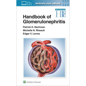 Handbook of Glomerulonephritis First edition Νεφρολογία