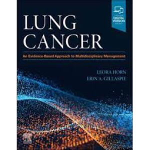 Lung Cancer, An Evidence-Based Approach to Multidisciplinary Management Πνευμονολογία