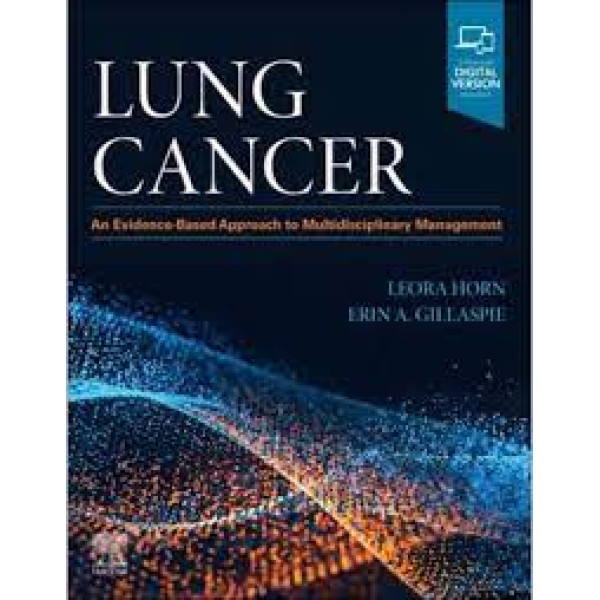 Lung Cancer, An Evidence-Based Approach to Multidisciplinary Management Πνευμονολογία