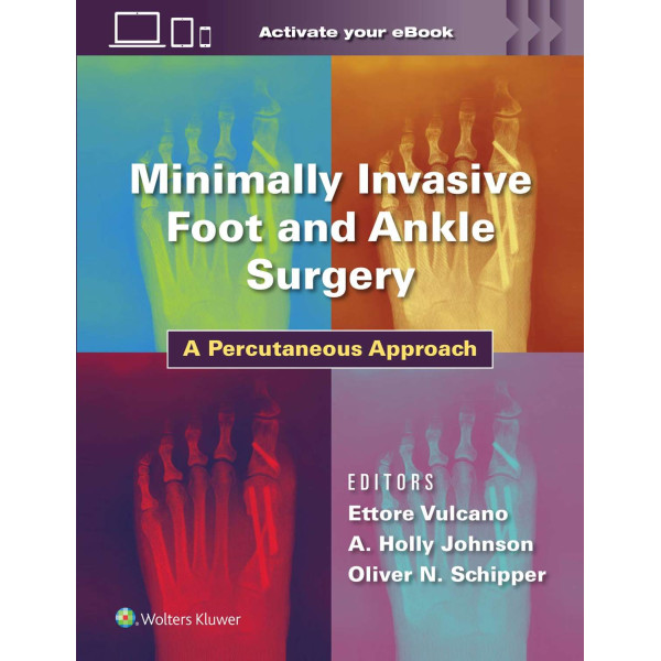 Minimally Invasive Foot and Ankle Surgery A Percutaneous Approach, First edition Ορθοπεδική
