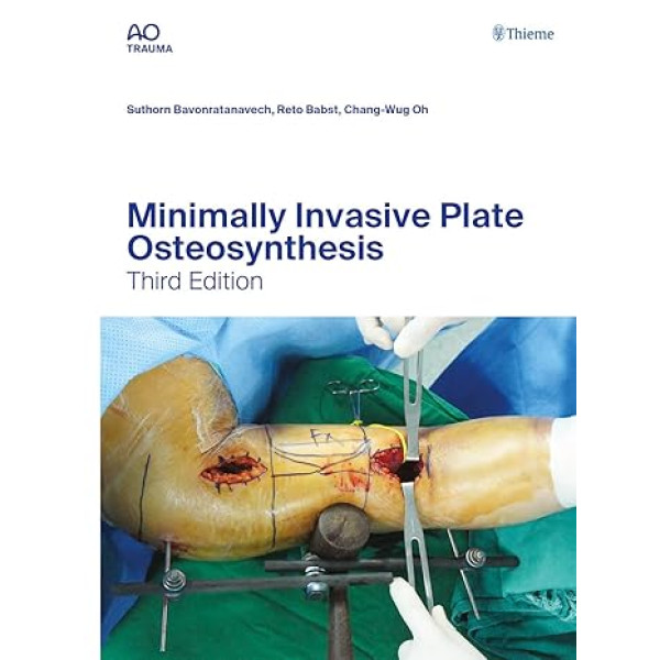 Minimally Invasive Plate Osteosynthesis Ορθοπεδική