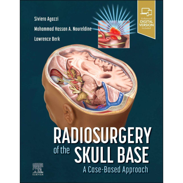 Radiosurgery of the Skull Base: A Case-Based Approach Νευροχειρουργική