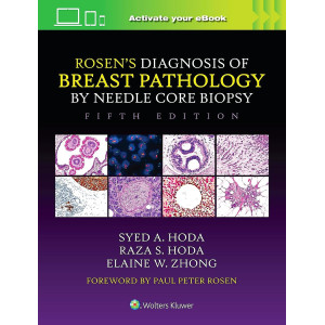  Rosen's Diagnosis of Breast Pathology by Needle Core Biopsy Παθολογοανατομία