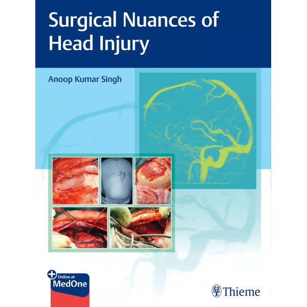 Surgical Nuances of Head Injury Νευροχειρουργική