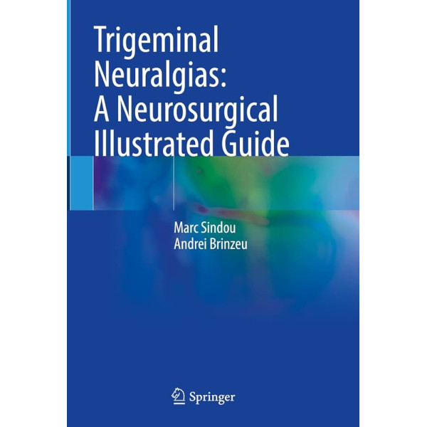 Trigeminal Neuralgias: A Neurosurgical Illustrated Guide Νευροχειρουργική
