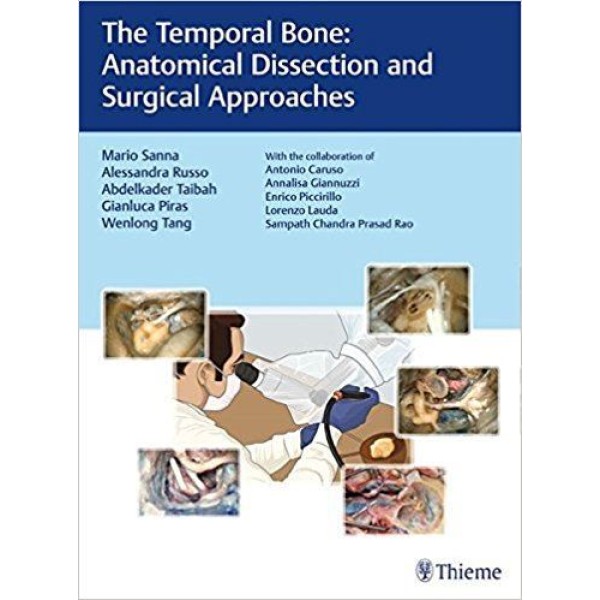 The Temporal Bone Anatomical Dissection and Surgical Approaches Ωτορινολαρυγκολογία