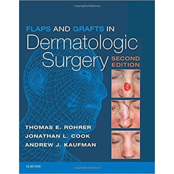 Flaps and Grafts in Dermatologic Surgery Δερματολογία