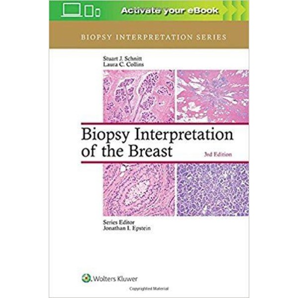 παθολογοανατομια - Biopsy Interpretation of the Breast Παθολογοανατομία