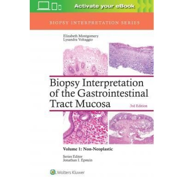 παθολογοανατομια - Biopsy Interpretation of the Gastrointestinal Tract Mucosa: Volume 1: Non-Neoplastic Παθολογοανατομία