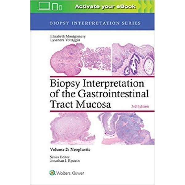 παθολογοανατομια - Biopsy Interpretation of the Gastrointestinal Tract Mucosa: Volume 2: Neoplastic Παθολογοανατομία