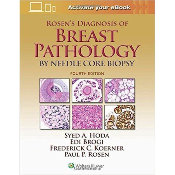 παθολογοανατομια - Rosen's Diagnosis of Breast Pathology by Needle Core Biopsy Παθολογοανατομία