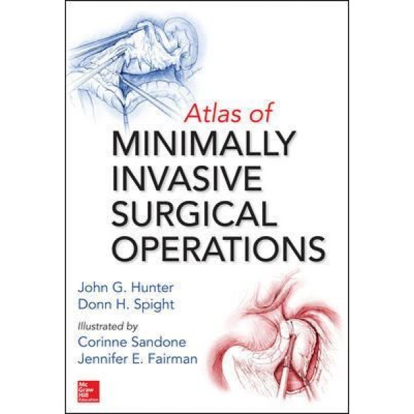 Atlas Of Minimally Invasive Surgical Operations Χειρουργική