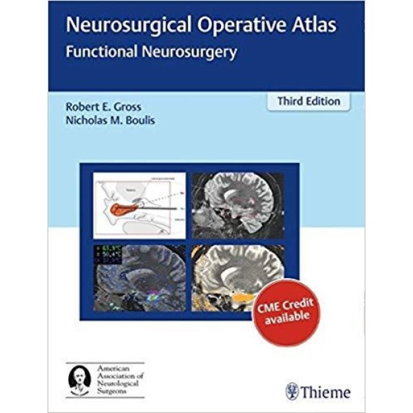 Neurosurgical Operative Atlas Functional Neurosurgery Νευροχειρουργική