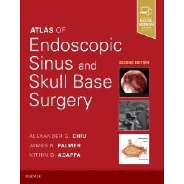 Atlas of Endoscopic Sinus and Skull Base Surgery Ωτορινολαρυγκολογία