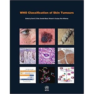 παθολογοανατομια - Who Classification of Skin Tumours Δερματολογία