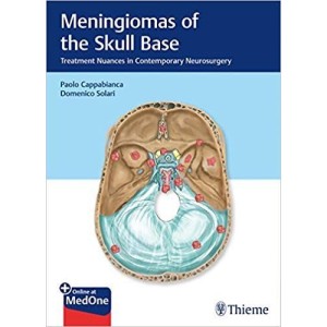 Meningiomas of the Skull Base: Treatment Nuances in Contemporary Neurosurgery Ωτορινολαρυγκολογία
