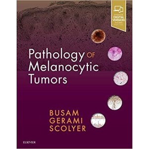 παθολογοανατομια - Pathology of Melanocytic Tumors Δερματολογία