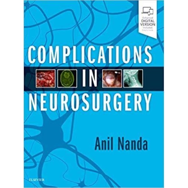 Complications in Neurosurgery Νευροχειρουργική