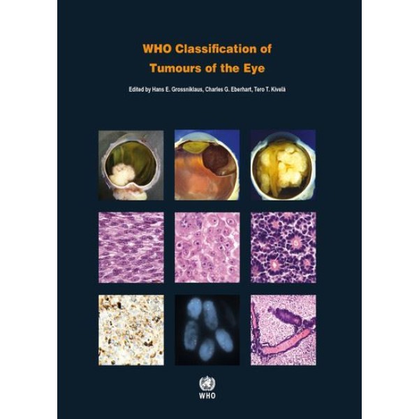 παθολογοανατομια - WHO Classification of Tumours of the Eye. Fourth Edition Παθολογοανατομία