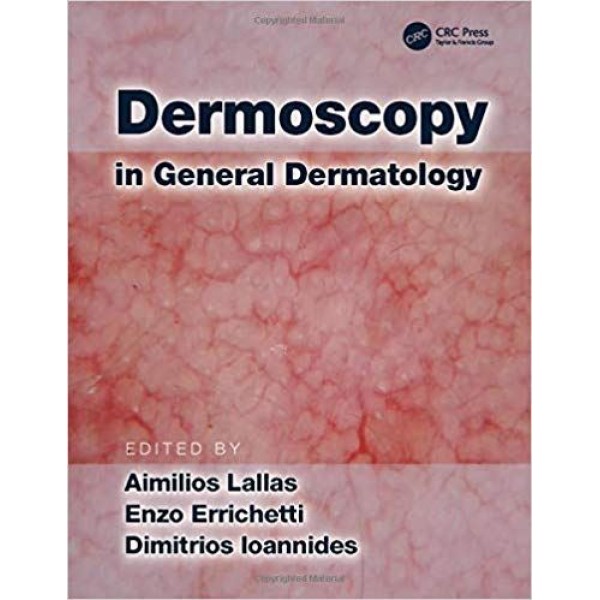 Dermoscopy in General Dermatology Δερματολογία