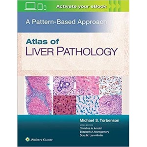 παθολογοανατομια - Atlas of Liver Pathology: A Pattern-Based Approach Παθολογοανατομία