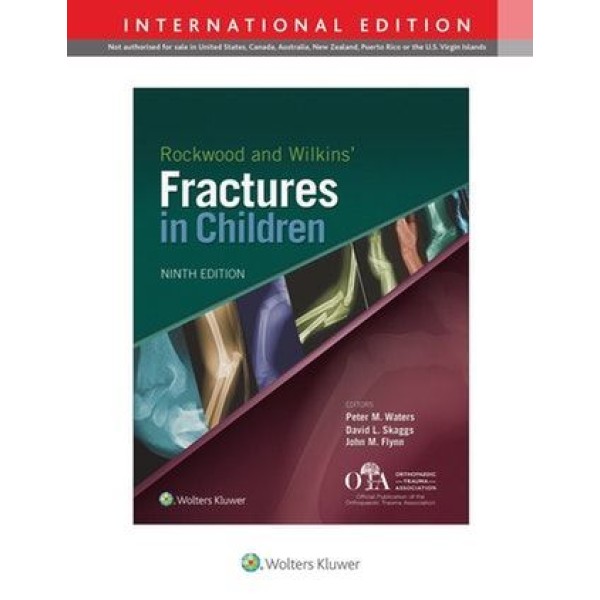 Rockwood and Wilkins Fractures in Children, International Edition Ορθοπεδική