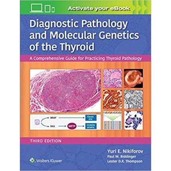 παθολογοανατομια - Diagnostic Pathology and Molecular Genetics of the Thyroid A Comprehensive Guide for Practicing Thyroid Pathology Παθολογοανατομία
