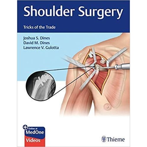 Shoulder Surgery Tricks of the Trade Ορθοπεδική