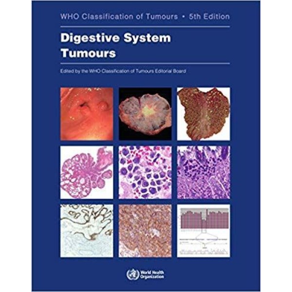 παθολογοανατομια - WHO Classification of Tumours. Digestive System Tumours Παθολογοανατομία