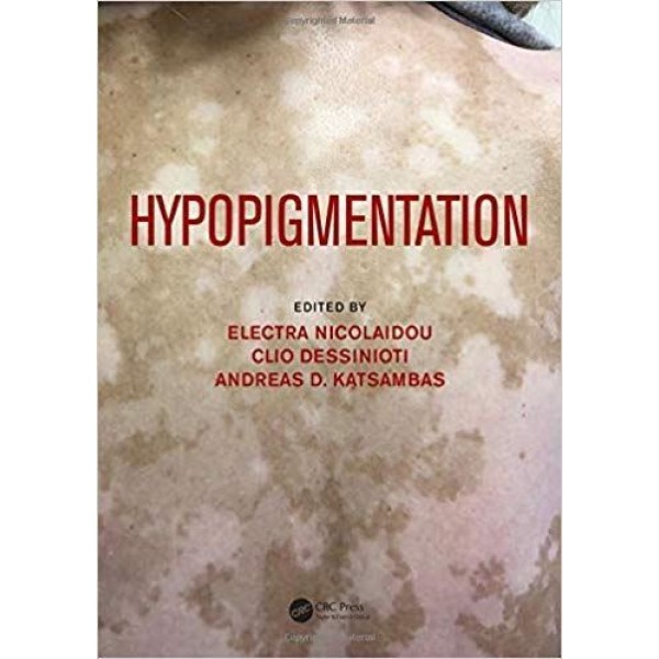 Hypopigmentation Δερματολογία