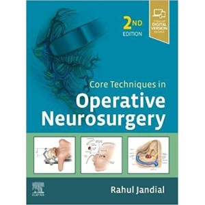 Core Techniques in Operative Neurosurgery Νευροχειρουργική