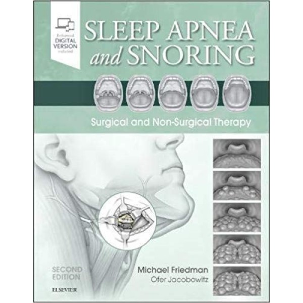 Sleep Apnea and Snoring, Surgical and Non-Surgical Therapy Ωτορινολαρυγκολογία