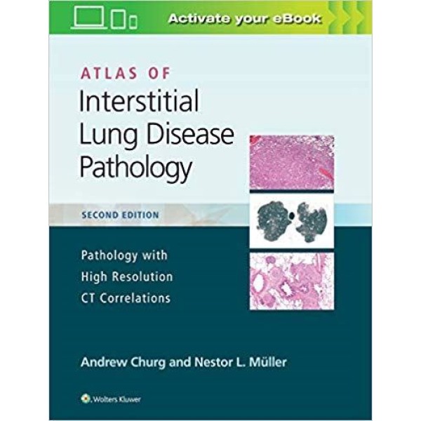 παθολογοανατομια - Atlas of Interstitial Lung Disease Pathology Παθολογοανατομία