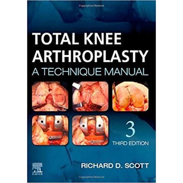 Total Knee Arthroplasty, A Technique Manual Ορθοπεδική