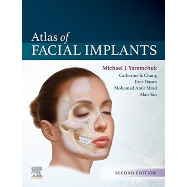 Atlas of Facial Implants Πλαστική Χειρουργική
