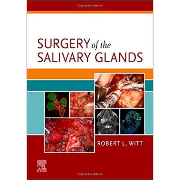 Surgery of the Salivary Glands Ωτορινολαρυγκολογία