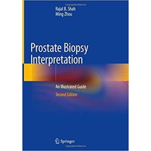 παθολογοανατομια - Prostate Biopsy Interpretation An Illustrated Guide Παθολογοανατομία