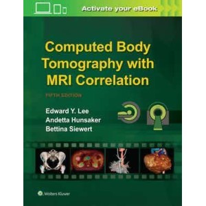 Computed Body Tomography with MRI Correlation Ακτινολογία