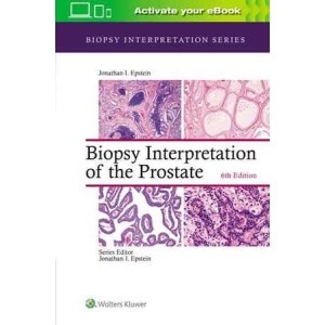 παθολογοανατομια - Biopsy Interpretation of the Prostate Παθολογοανατομία