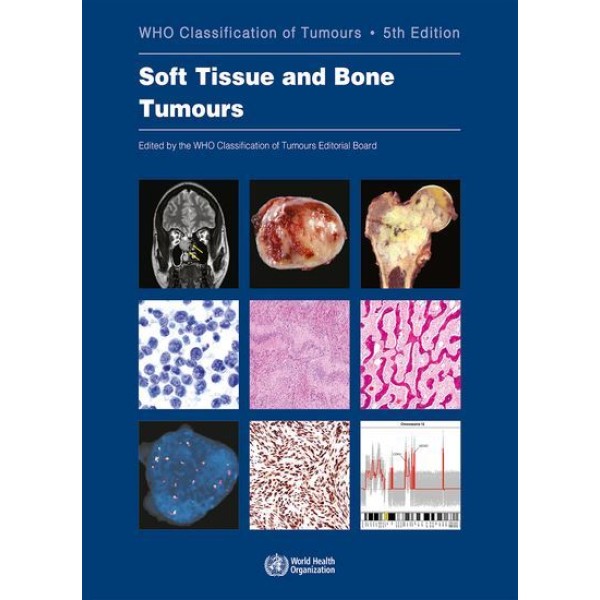 παθολογοανατομια - WHO Classification of Tumours, Soft Tissue and Bone Tumours Παθολογοανατομία