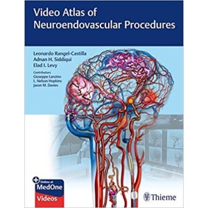 Video Atlas of Neuroendovascular Procedures Νευρολογία