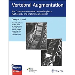 Vertebral Augmentation The Comprehensive Guide to Vertebroplasty, Kyphoplasty, and Implant Augmentation Ορθοπεδική