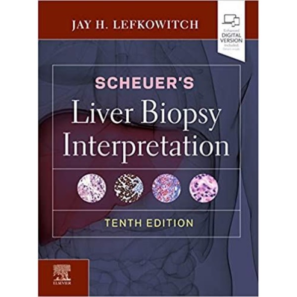 παθολογοανατομια - Scheuer's Liver Biopsy Interpretation 10th Edition Παθολογοανατομία